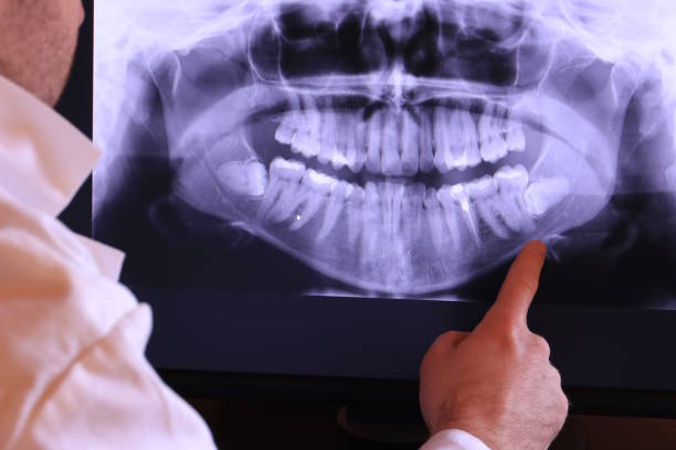 Best Emergency Treatment for Jaw Pain or Injury in West Menlo Park, CA