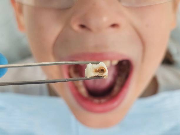Reliable CA Emergency Dental Service Solutions